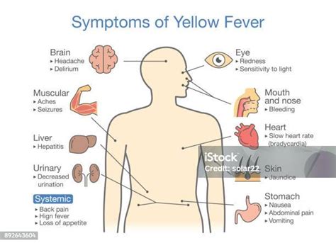 la fièvre jaune symptômes